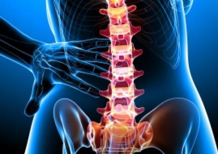 What hurts the spine hernias