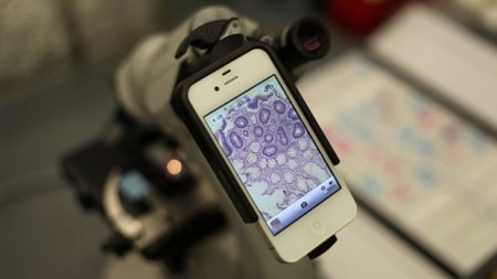 Microscopes on smartphones can detect skin cancer
