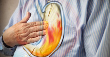 How to get rid of heartburn: treatment of water and grass