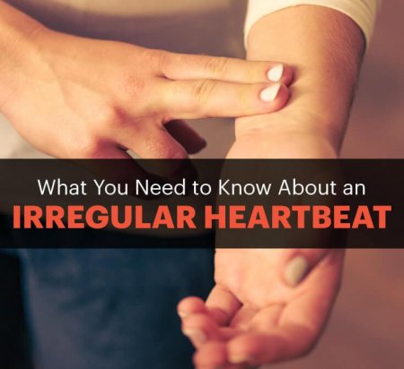 Irregular Heartbeat: What You Need to Know + How to Naturally Treat