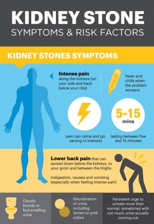 What’s Causing Your Kidney Stone Symptoms? Plus 5 Remedies That Work