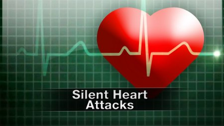 Quiet killers: Silent heart attacks may have deafening consequences