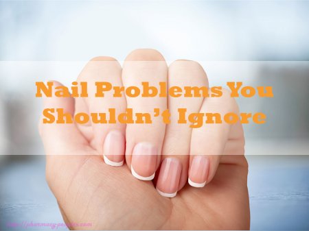 Nail Problems You Shouldn’t Ignore